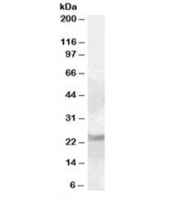 Western blot testing of human cerebellum lysate with RAB8A antibody at 0.1ug/ml. Predicted molecular weight: ~24kDa.