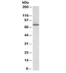 Western blot testing of HeLa lysate with Transglutaminase 4 antibody at 1ug/ml. Predicted molecular weight: ~77kDa.