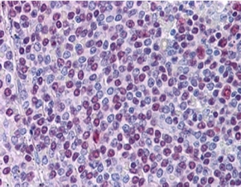 IHC staining of FFPE human spleen using NONO antibody at 3.8ug/ml. HIER: steamed with pH6 citrate buffer, AP-staining.