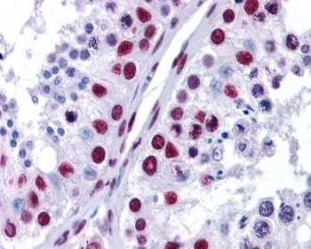 IHC staining of FFPE human testis using NONO antibody at 3.8ug/ml. HIER: steamed with pH6 citrate buffer, AP-staining.