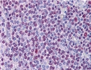 IHC staining of FFPE human spleen using NONO antibody at 3.8ug/ml. HIER: steamed with pH6 citrate buffer, AP-staining.