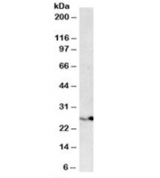 Western blot testing of HEK293 lysate with PSMB4 antibody at 0.1ug/ml. Predicted molecular weight ~29 kDa, commonly observed at 26-29 kDa.