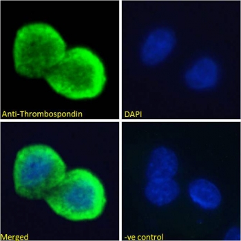 Immunoflorescence testing of permeabilized human HepG2 cells with Thrombospondin antibody at 10ug/ml. Blue = DAPI nuclear counterstain.