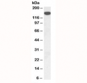 Western blot testing of mouse kidney lysate with Thrombospondin antibody at 1ug/ml. Expected molecular weight ~130 kDa (unmodified), 155~200 kDa (glycosylated).