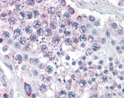 IHC testing of FFPE human testis tissue with GPSM2 antibody at 5ug/ml. Required HIER: steamed antigen retrieval with pH6 citrate buffer; AP-staining.
