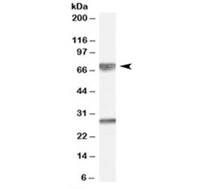 Western blot testing of human cerebellum lysate with GPSM2 antibody at 0.01ug/ml. Predicted molecular weight: ~76kDa. Both observed bands are blocked by addition of the immunizing peptide.~