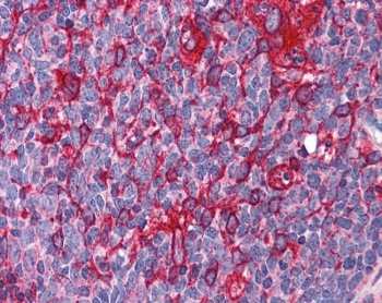 IHC testing of FFPE human tonsil tissue with ARL6IP5 antibody at 3.75ug/ml. Required HIER: steamed antigen retrieval with pH6 citrate buffer; AP-staining.