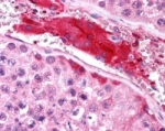 IHC testing of FFPE human testis with HRS antibody at 2.5ug/ml. HIER: steamed with pH6 citrate buffer, AP-staining.
