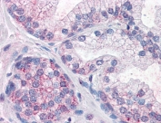 IHC testing of FFPE human prostate tissue with PDE11A antibody at 10ug/ml. Required HIER: steamed antigen retrieval with pH6 citrate buffer; AP-staining.