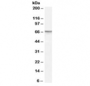 Western blot testing of human prostate lysate with PDE11A antibody at 1ug/ml. Predicted molecular weight: ~66 kDa.