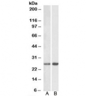 Western blot testing with MOBKL3 antibody: Lane A: mouse brain at 0.3ug/ml; Lane B: rat brain at 1ug/ml. Predicted/observed molecular weight: ~26kDa.
