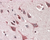 IHC staining of FFPE human cerebral cortex with MOBKL3 antibody at 5ug/ml. HIER: steamed with pH6 citrate buffer, AP-staining.