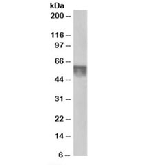 Western blot testing of human testis lysate with KPNA4 at 0.5ug/ml. Predicted molecular weight: ~58kDa.