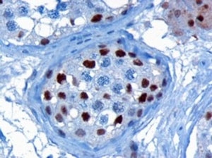IHC staining of FFPE human testis with KPNA4 antibody at 3ug/ml. HIER: microwaved with pH6 citrate buffer, HRP-staining.
