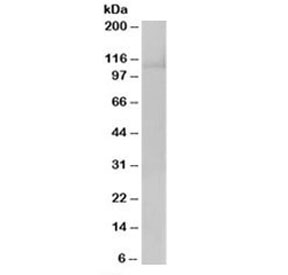Western blot testing of HeLa lysate with RANBP16 antibody at 0.5ug/ml. Predicted molecular weight: ~124kDa.~