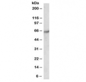 Western blot testing of human brain (cerebral cortex) lysate with PAK1 antibody at 0.5 ug/ml. Expected molecular weight 60~70 kDa.