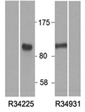 Western blot of HEK293 lysate overexpressing human HIC1 tested with HIC1 antibody at (0.5ug/ml). Mock transfection lanes also shown. Predicted molecular weight: ~77kDa but can be observed at ~100kDa.~