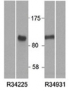 Western blot of HEK293 lysate overexpressing human HIC1 and tested with HIC1 antibody at 0.5ug/ml (right lane is mock transfection).