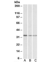 Western blot testing of human lymph node [A], mouse spleen [B] and rat spleen [C] lysates with GNB2L1 antibody at 0.1ug/ml. Predicted molecular weight: ~35kDa.~