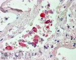 IHC staining of FFPE human lung with CES1 antibody at 2.5ug/ml. HIER: steamed with pH6 citrate buffer, AP-staining.