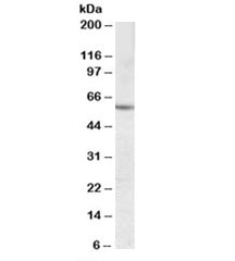 Western blot testing of human liver lysate with CES1 antibody at 0.03ug/ml. Predicted molecular weight: ~63kDa.~