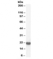Western blot testing of human brain lysate with Peroxiredoxin 2 antibody at 1ug/ml. Predicted molecular weight: ~22kDa.