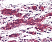 IHC testing of FFPE human breast tissue with DAGLA antibody at 5ug/ml. Required HIER: steamed antigen retrieval with pH6 citrate buffer; AP-staining.