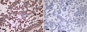 IHC testing of FFPE human placental tissue with CD32 antibody (left) at 8ugl/ml and without primary Ab (right). Required HIER: steamed antigen retrieval with pH6 citrate buffer; HRP-staining.