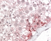 IHC staining of FFPE human testis with ABCD3 antibody at 4ug/ml. HIER: steamed with pH6 citrate buffer, AP-staining.