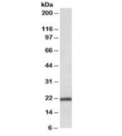 Western blot testing of human pancreas lysate with TMEM205 antibody at 0.03ug/ml. Predicted molecular weight: ~21kDa.
