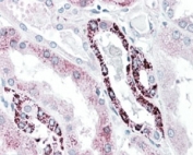 IHC staining of FFPE human kidney with PLK3 antibody at 5ug/ml. HIER: steamed with pH6 citrate buffer, AP-staining.