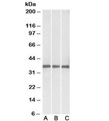 Western blot testing of human [A], mouse [B] and rat [C] heart lysates with Malate dehydrogenase 1 antibody at 0.03ug/ml. Predicted molecular weight: ~36kDa.~