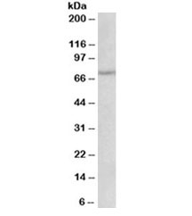 Western blot testing of rat heart lysate with NGFR antibody at 1ug/ml. Predicted molecular weight ~45/75kDa (unmodified/glycosylated).
