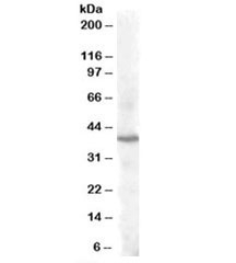 Western blot testing of human cerebellum lysate with PITX3 antibody at 1ug/ml. Predicted molecular weight: ~32kDa, routinely observed at 35-40kDa.