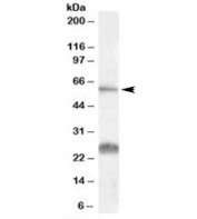 Western blot testing of human kidney lysate with SLC47A1 antibody at 0.1ug/ml. The expected ~60kDa band and the additional ~26kDa band are both blocked by the immunizing peptide.