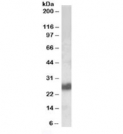 Western blot testing of human tonsil lysate with CD90 antibody at 0.1ug/ml. Predicted molecular weight 18~35kDa depending on glycosylation level.