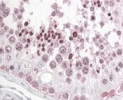 IHC testing of FFPE human testis with PATJ antibody at 4ug/ml. HIER: steamed with pH6 citrate buffer, AP-staining. Spermatid staining is seen.
