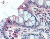 IHC testing of FFPE human colon tissue with LASP1 antibody at 2.5ug/ml. Steamed antigen retrieval with citrate buffer pH 6, AP-staining.