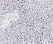 IHC testing of FFPE human spleen (nucleoli staining) with BAT3 antibody at 4ug/ml. HIER: steamed with pH6 citrate buffer, AP-staining.