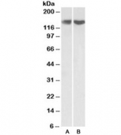 Western blot testing of HEK293 [A] and HeLa [B] lysate with REST antibody at 0.3ug/ml. Predicted molecular weight ~122kDa but routinely observed at ~140kDa.