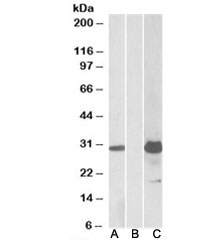 Western blot testing of HEK293 lysate overexpressing human KCTD11-FLAG with KCTD11 antibody (1ug/ml) in lane A and anti-FLAG (1/5000) in lane C. Mock-transfected HEK293 probed with KCTD11 Ab (1ug/ml) in lane B. Predicted molecular weight: ~26/30kDa (isoforms 1/2).
