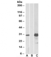 Western blot testing of HEK293 lysate overexpressing human KCTD11 with DYKDDDDK tag with KCTD11 antibody (1ug/ml) in Lane A and probed with anti-DYKDDDDK tag (1/5000) in lane C. Mock-transfected HEK293 probed with KCTD11 antibody (1ug/ml) in Lane B.