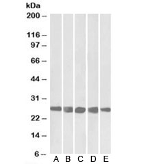 Western blot testing of A) mouse NIH3T3 and human B) HeLa, C) K562, D) MCF7 and E) HepG2 lysates with CSNK2B antibody at 0.3ug/ml. Predicted molecular weight: ~25kDa.