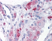 IHC testing of FFPE human testis tissue with MTA1 antibody at 3.75ug/ml. Required HIER: steamed antigen retrieval with pH6 citrate buffer; AP-staining.