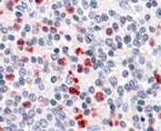 IHC staining of FFPE human spleen with PGRP-S antibody at 4ug/ml. HIER: steamed with pH6 citrate buffer, AP-staining.