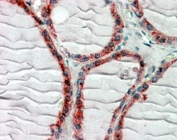 IHC staining of FFPE human thyroid gland with CLIP antibody with 2.5ug/ml. HIER: steamed with pH6 citrate buffer, AP-staining.