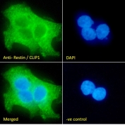 Immunofluorescent staining of fixed and permeabilized human A431 cells with CLIP antibody (green) at 10ug/ml and DAPI nuclear stain (blue).