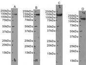Western blot testing of human A) HEK293, 2) HepG2, 3) A549 and 4) HeLa cell lysate with CLIP antibody. Predicted molecular weight: 156-162 kDa (multiple isoforms), commonly observed at up to ~170 kDa.