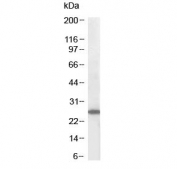 Western blot testing of MOLT4 lysate with SOCS3 antibody at 1ug/ml. Predicted molecular weight ~24 kDa.