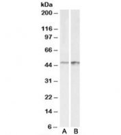 Western blot testing of A431 [A] and HeLa [B] lysates with E2F4 antibody at 0.3ug/ml. Expected molecular weight ~44 kDa (unmodified) and 60-65 kDa (phosphorylated).